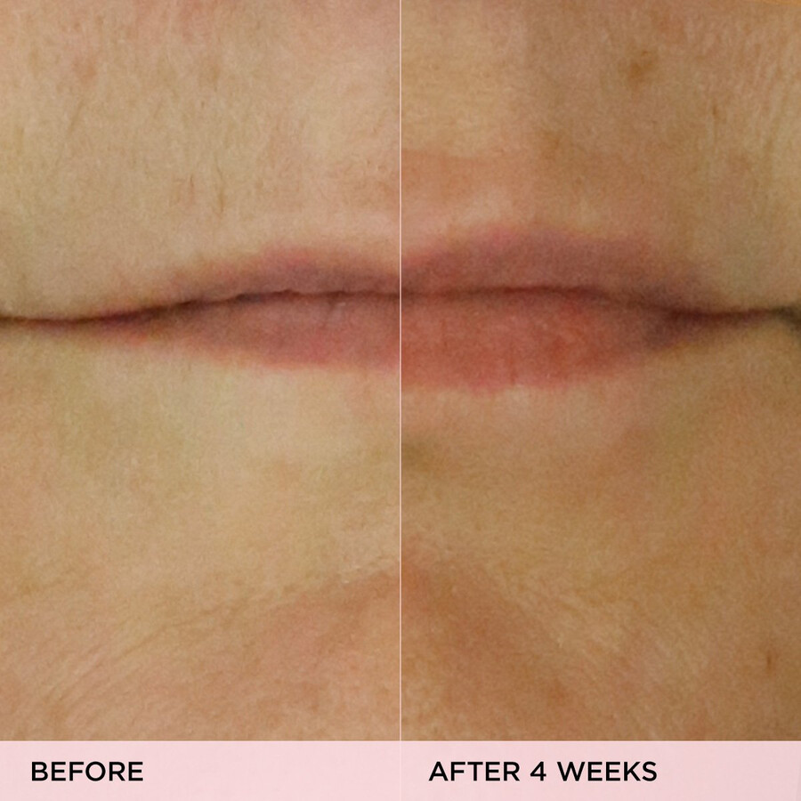 das kissu lip treatment volumen-wiederherstellende lippenserum